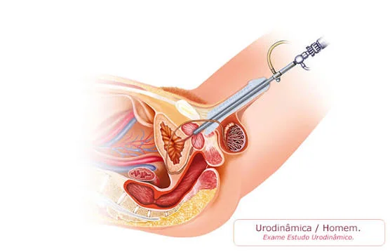 Estudo urodinâmico