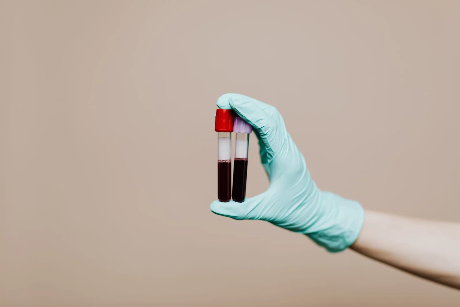Perfil de IST por PCR e sorologias