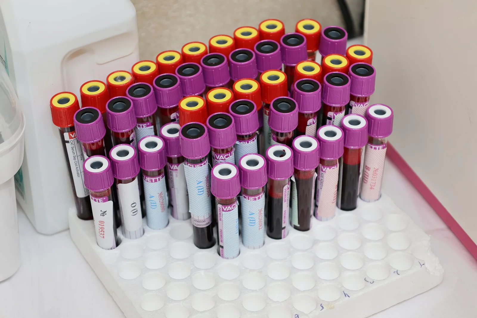 Exames laboratoriais
